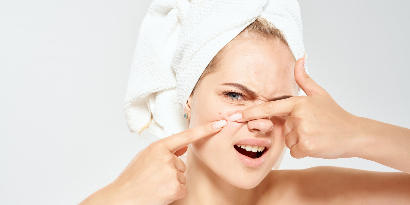11 conseils pour prévenir l’acné